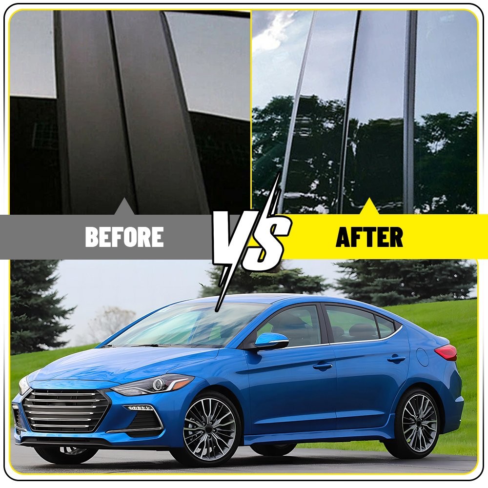 For 2017-20 Hyundai Elantra Sedan Black Pillar Posts Set Door Window Trim EPPE
